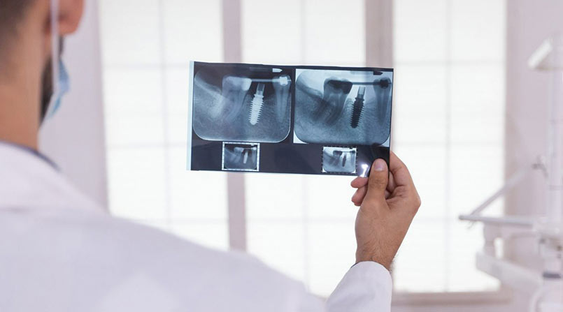 Radiografia Periapical: precisão no diagnóstico odontológico